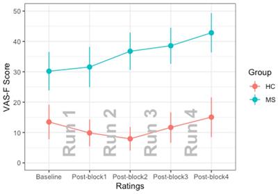 Signal Detection Theory as a Novel Tool to Understand Cognitive Fatigue in Individuals With Multiple Sclerosis